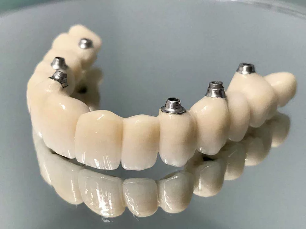 protesis dental gijon