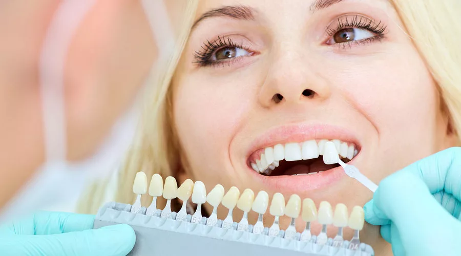 soluciones estetica dental